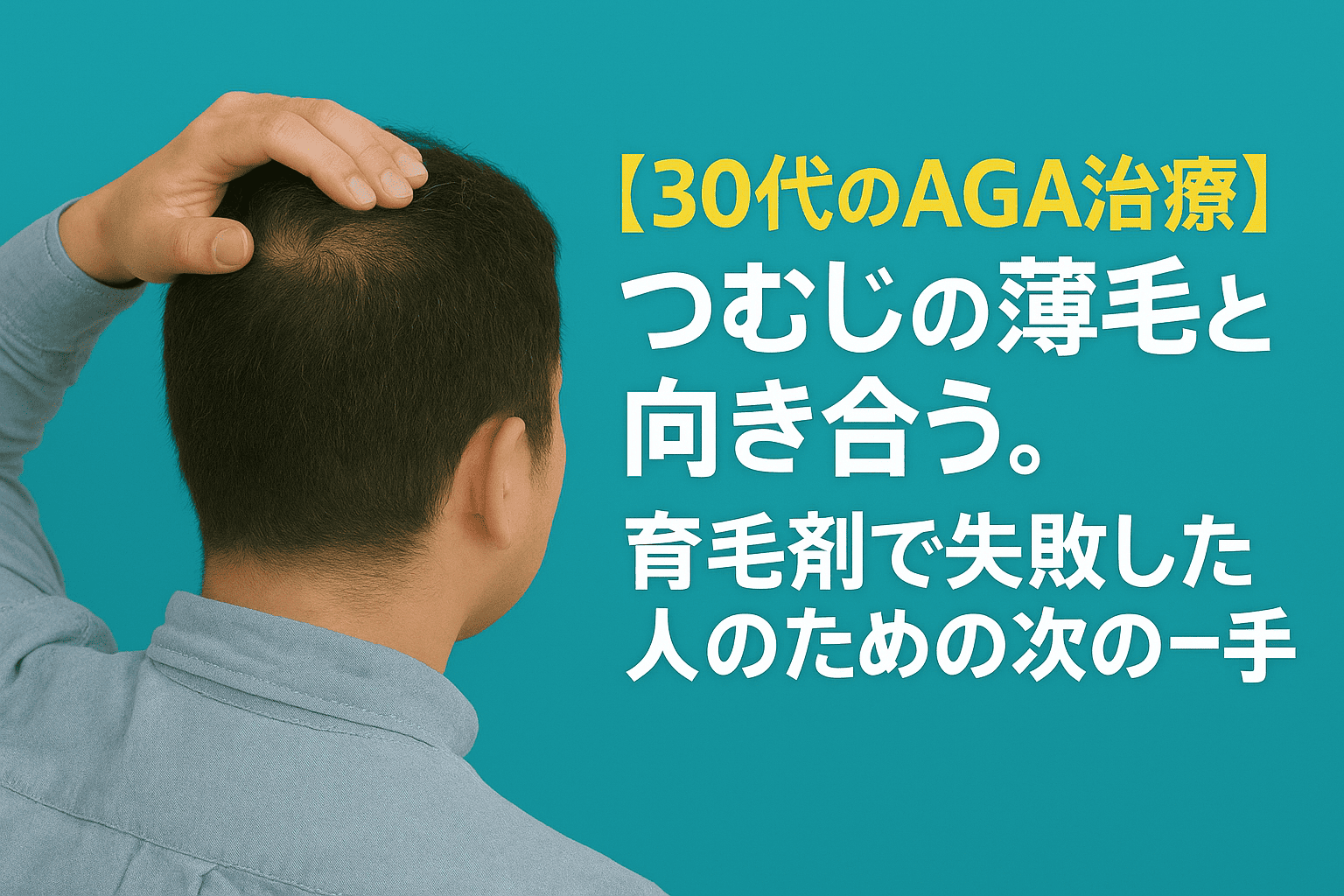 【30代のAGA治療】つむじの薄毛と向き合う| 育毛剤で失敗した人のための次の一手